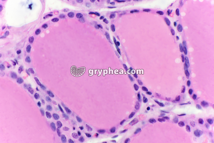 Thyroïde x200 - gryphea.com